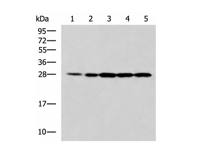 PSMA6 Polyclonal Antibody Reactivity Human