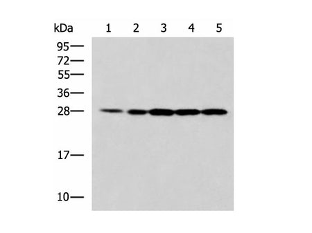PSMA6 Polyclonal Antibody Reactivity Human