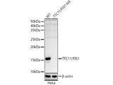(KO Validated) TTC11/FIS1 Polyclonal Antibody