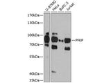 PFKP Polyclonal Antibody