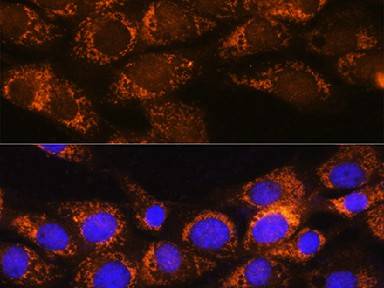 BCKDHA Polyclonal Antibody