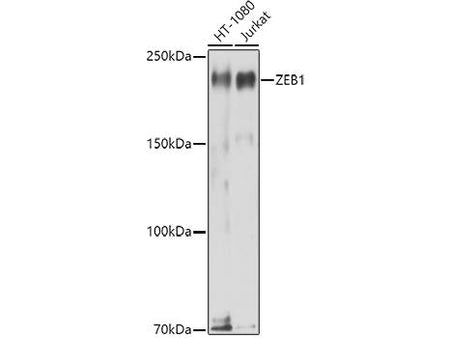 ZEB1 Polyclonal Antibody