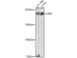 ZEB1 Polyclonal Antibody