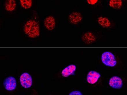 (KO Validated) p53 Polyclonal Antibody