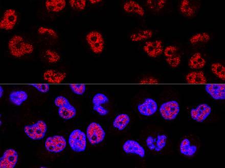 (KO Validated) p53 Polyclonal Antibody