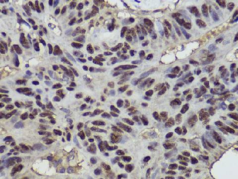 (KO Validated) p53 Polyclonal Antibody