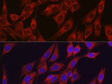 VEGF Polyclonal Antibody