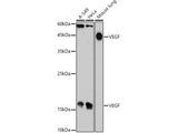 VEGF Polyclonal Antibody