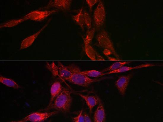 TFEB Polyclonal Antibody