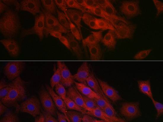 TFEB Polyclonal Antibody