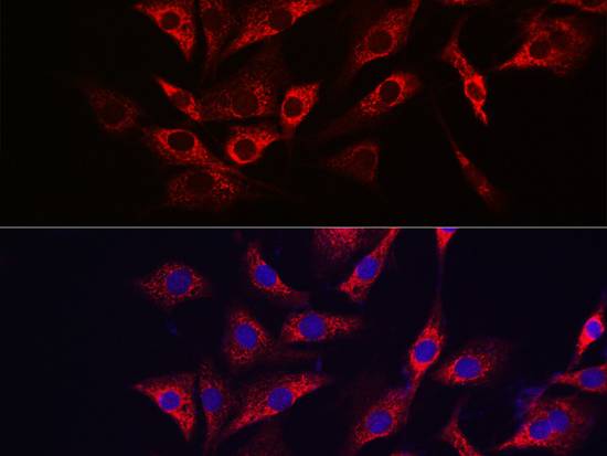 TFEB Polyclonal Antibody