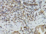 TFEB Polyclonal Antibody