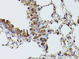TFEB Polyclonal Antibody