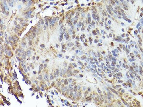 TFEB Polyclonal Antibody