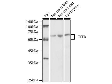 TFEB Polyclonal Antibody - Biomarkers - Elabscience Biotechnology - MSE Supplies