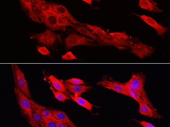 CASP1 Polyclonal Antibody