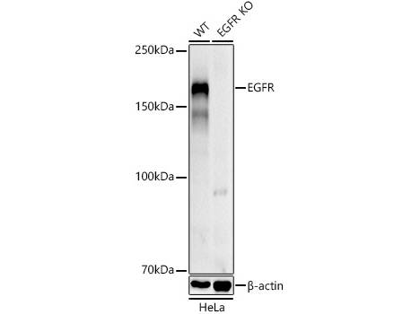 KO Validated) EGFR Polyclonal Antibody