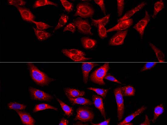 (KO Validated) PSAP Polyclonal Antibody