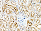 (KO Validated) PSAP Polyclonal Antibody