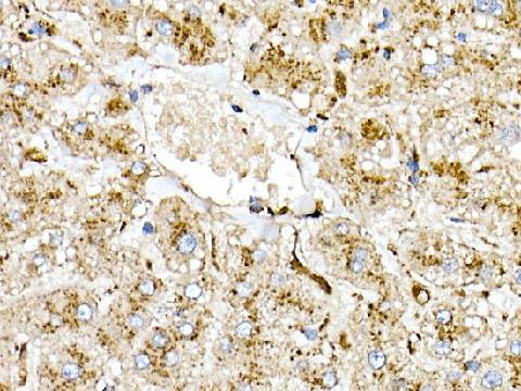 (KO Validated) PSAP Polyclonal Antibody