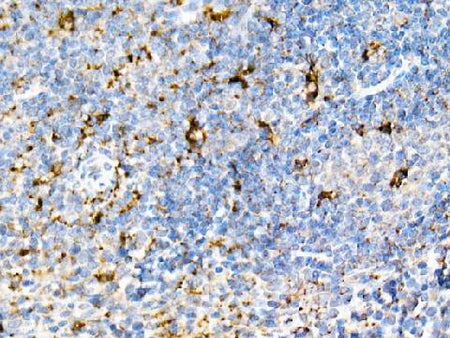 (KO Validated) PSAP Polyclonal Antibody