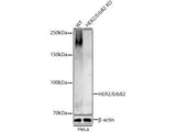 (KO Validated) HER2/ErbB2 Polyclonal Antibody