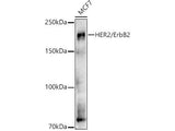 (KO Validated) HER2/ErbB2 Polyclonal Antibody