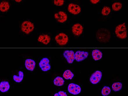 KDM1A Polyclonal Antibody