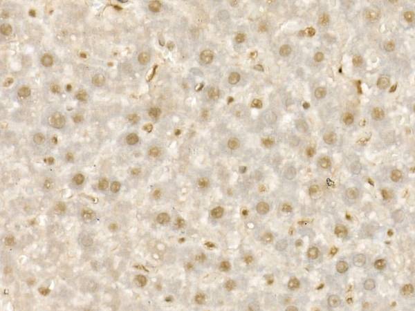 KDM1A Polyclonal Antibody
