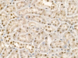 KDM1A Polyclonal Antibody