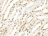 KDM1A Polyclonal Antibody