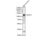KDM1A Polyclonal Antibody