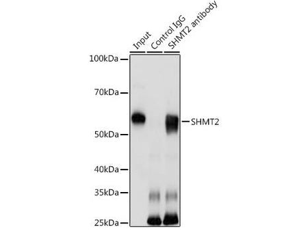 SHMT2 Polyclonal Antibody