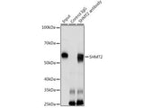 SHMT2 Polyclonal Antibody