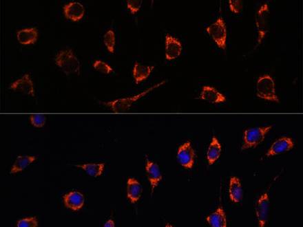 SHMT2 Polyclonal Antibody
