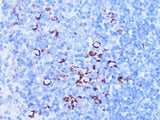 SHMT2 Polyclonal Antibody