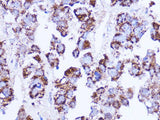 SHMT2 Polyclonal Antibody