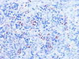 SHMT2 Polyclonal Antibody