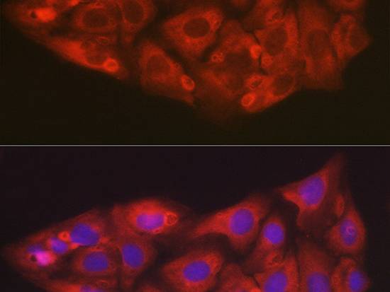 SOD2 Polyclonal Antibody
