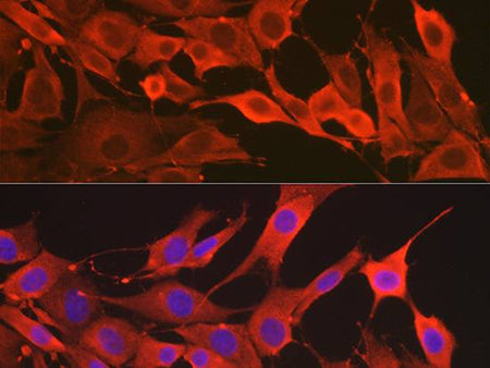 SOD2 Polyclonal Antibody