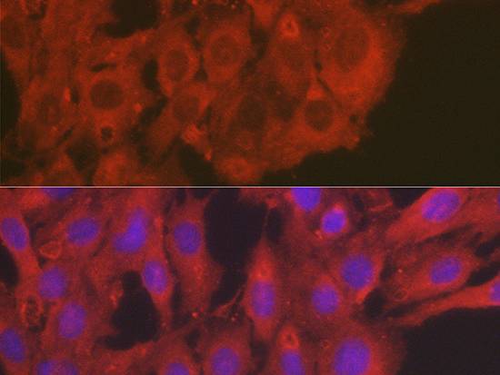 SOD2 Polyclonal Antibody