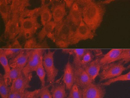 SOD2 Polyclonal Antibody