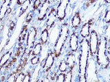SOD2 Polyclonal Antibody