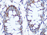 SOD2 Polyclonal Antibody
