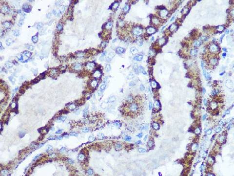 SOD2 Polyclonal Antibody