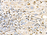 FSP1/S100A4 Polyclonal Antibody