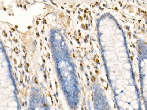FSP1/S100A4 Polyclonal Antibody