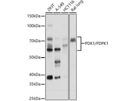 PDK1/PDPK1 Polyclonal Antibody