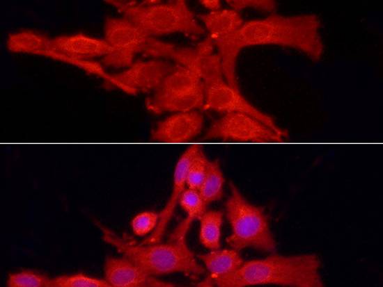 PTPN2 Polyclonal Antibody