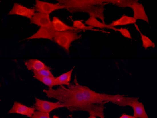 PTPN2 Polyclonal Antibody